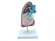Анатомическая модель патологии лёгких