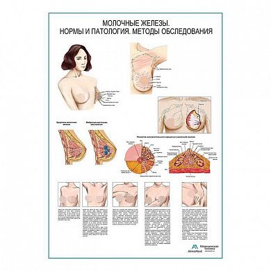 Молочные железы, мастопатия, самообследование, плакат глянцевый А1+/А2+