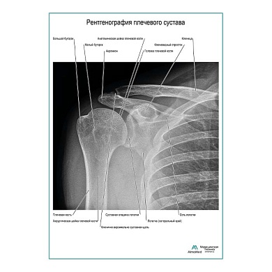 Рентгенография плечевого сустава плакат глянцевый  А1/А2