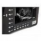 Портативный УЗИ-сканер AcuVista RS880b, Китай