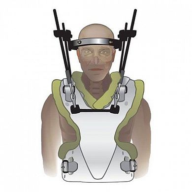 Аппарат &amp;amp;amp;amp;quot;Halo-cast &amp;amp;amp;amp;quot;ЦИТО&amp;amp;amp;amp;quot;-S (малый размер), Россия