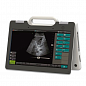 УЗИ сканер SmartScan 15