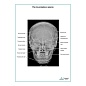 Рентгенография черепа плакат глянцевый  А1/А2