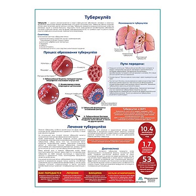 Туберкулёз медицинский плакат А1/A2