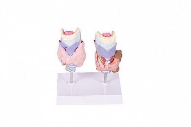 Анатомическая модель болезни щитовидной железы