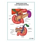 Лимфатические сосуды и узлы поджелудочной железы плакат глянцевый А1/А2