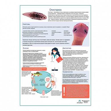 Описторхоз медицинский плакат А1/A2